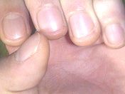 Left fingers
