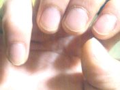Right fingers